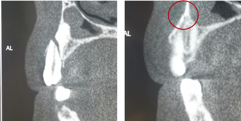 牙齿受外伤吃什么对牙好,牙齿受损伤引起牙痛怎么办