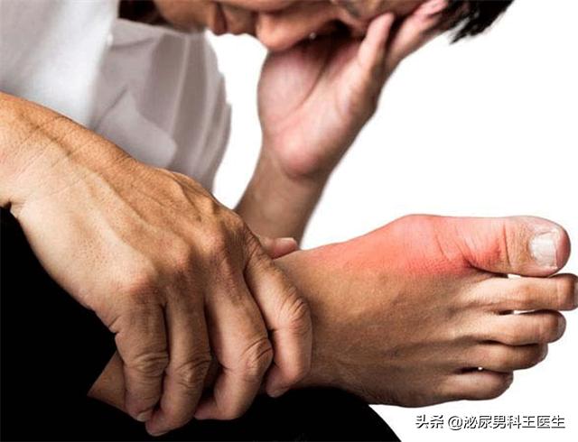 尿酸高如何让尿酸排出体外,尿酸高如何让尿酸排出