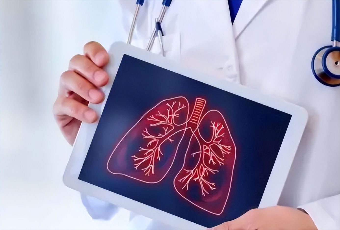 大蒜是肺结节发物吗,大蒜对肺结节有影响吗