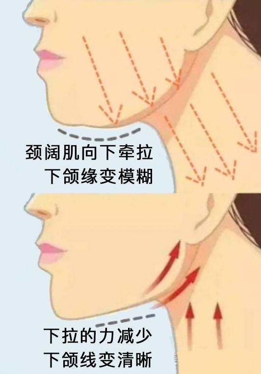 发腮和塌腮哪个更显老,发腮真的显老吗