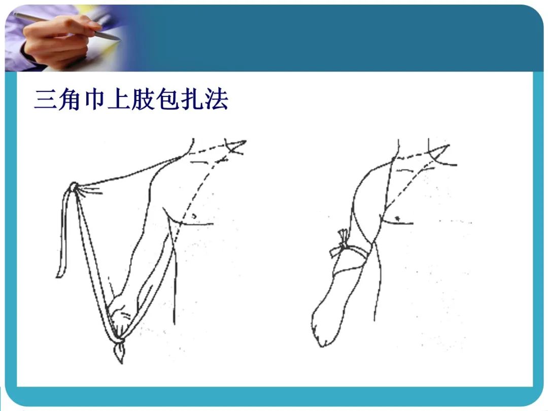 创伤后应激障碍ppt课件,创伤ppt课件