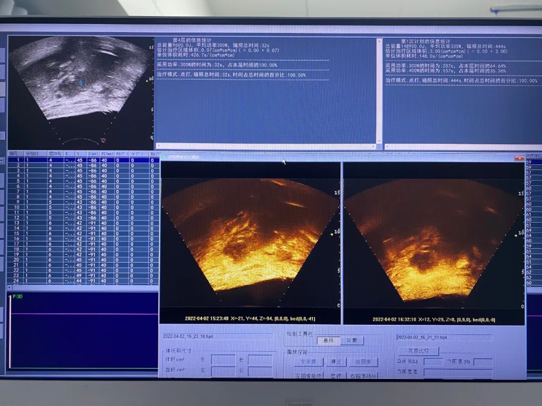 「诊疗我们更专业——技术篇」“强强联合隔山打牛”创首例