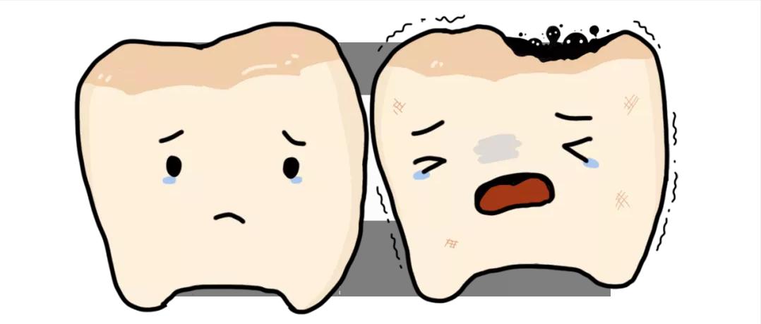 龋齿小洞不补,龋齿不及时补后果