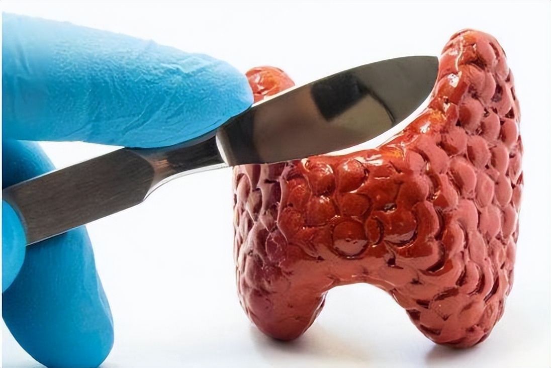 八段锦能治疗甲状腺癌吗,八段锦能够治疗乳腺甲状腺结节