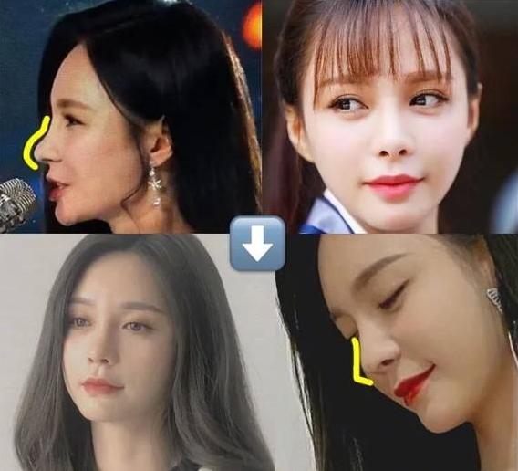 盘点整容失败惨不忍睹的30位女星,那些整容整失败的女明星