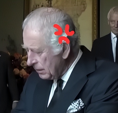 73岁查尔斯刚登基就身体堪忧？手指红肿像香肠，被拍到暴怒视频