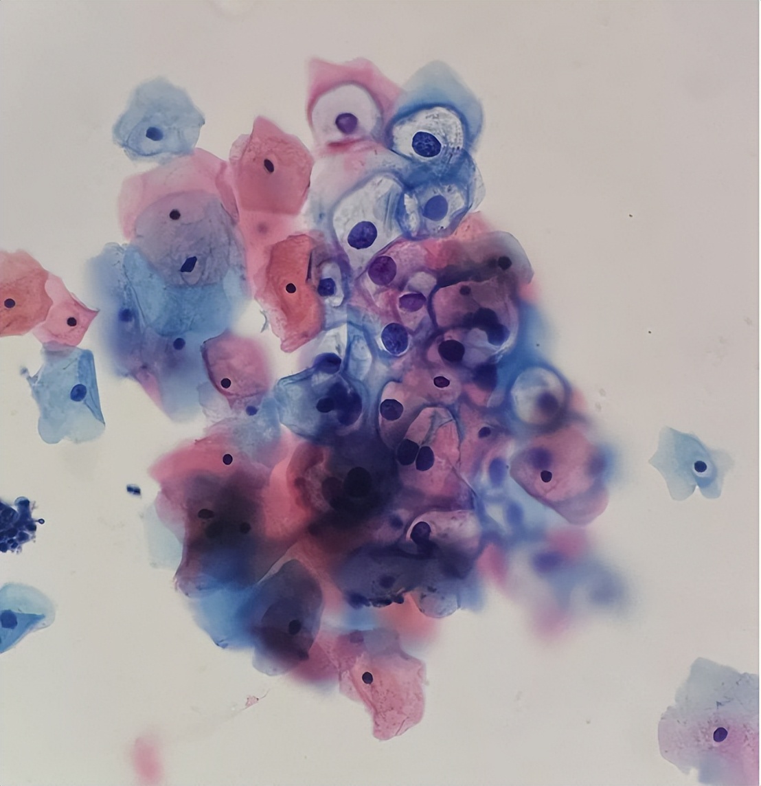 掌健识健康百科,宫颈hpv感染最新指南