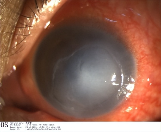 邓志宏几号坐诊,湘雅附三眼科邓志宏简历