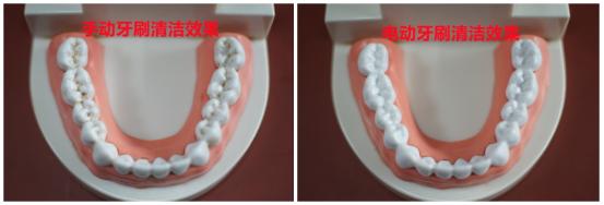 电动牙刷加冲牙器会对牙齿损害吗,超声波的电动牙刷能刷干净牙齿吗