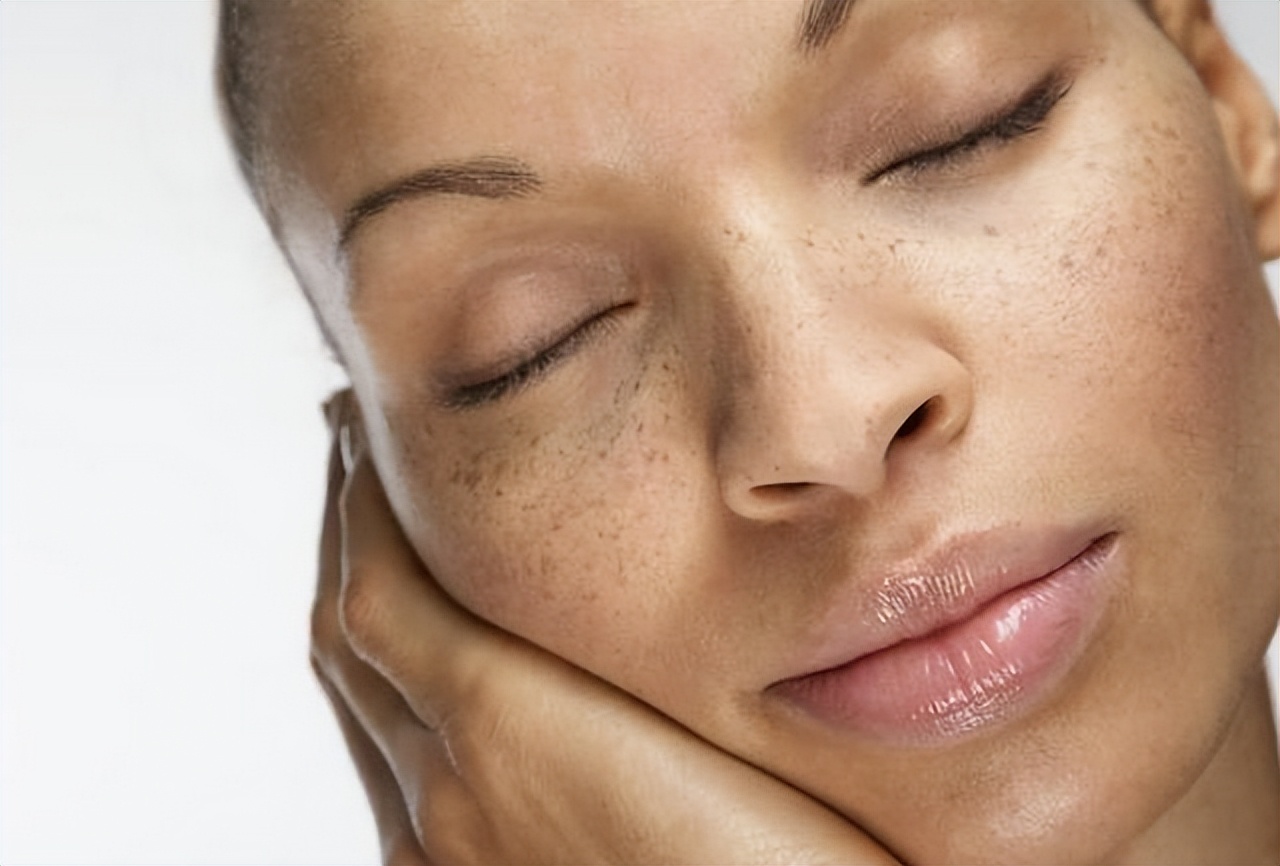 红霉素软膏可以去除老年斑么,红霉素软膏能够去除老人斑