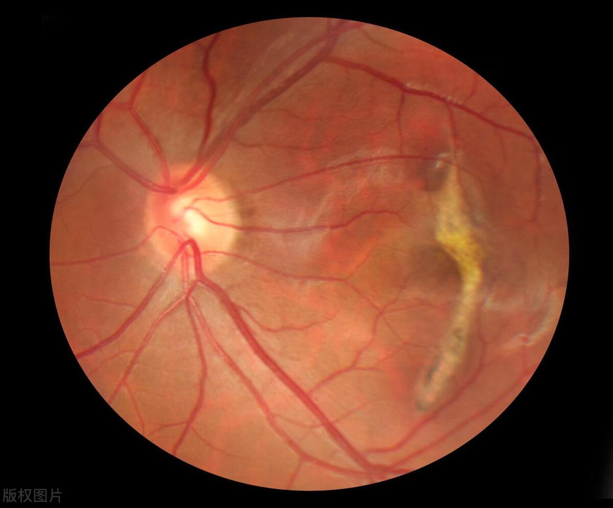 吃什么食物能对眼睛近视有帮助,近视多吃什么食物对眼睛好