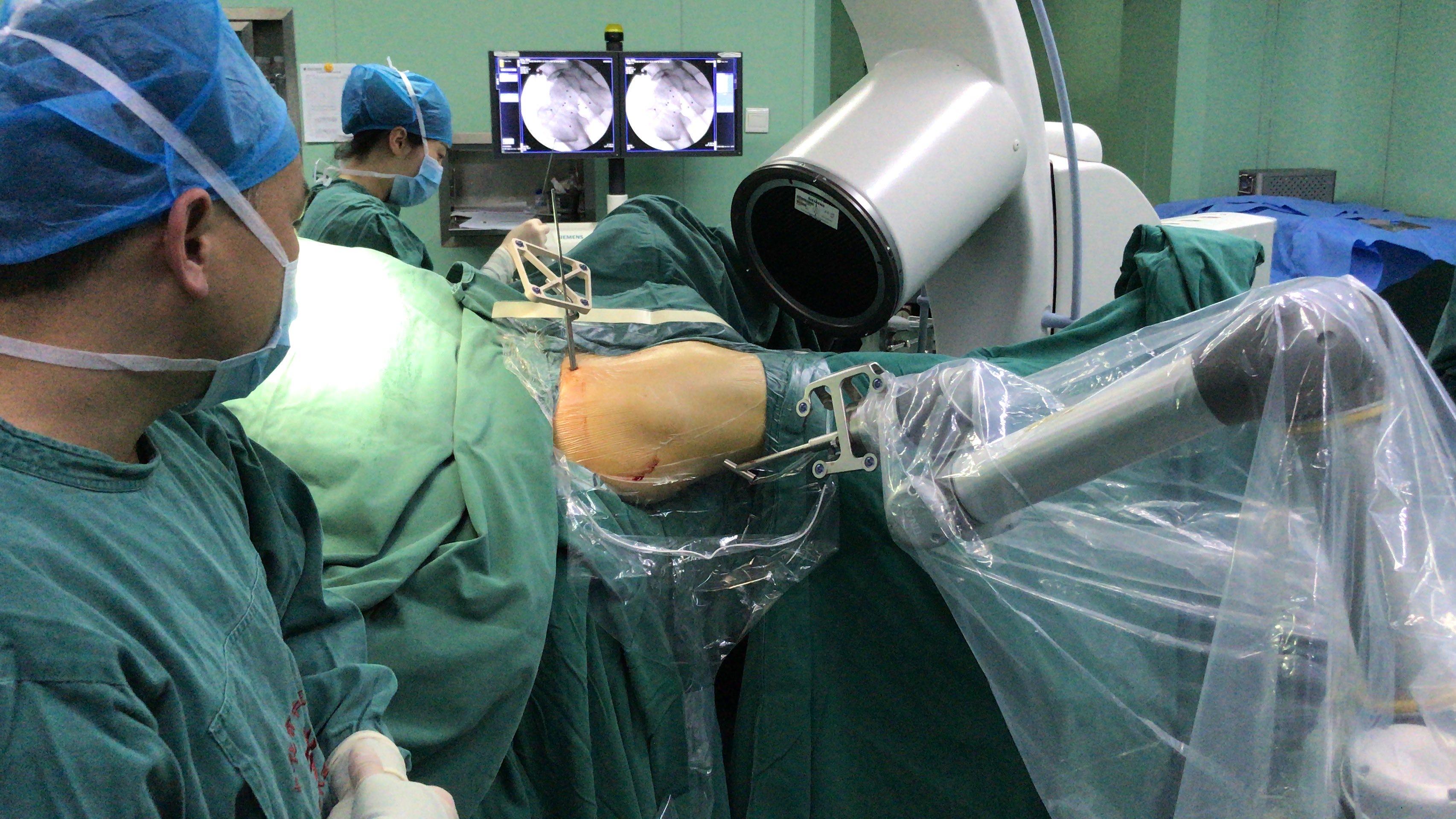 股骨颈骨折矫正仪器,骨科机器人好用吗