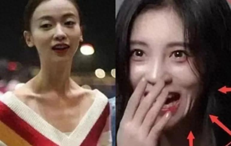 瘦到病态的审美,瘦到病态