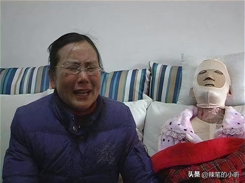 被泼硫酸毁容16岁女生,2017年18岁少女被泼硫酸毁容