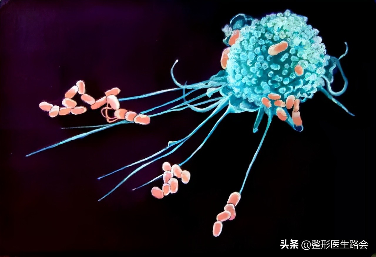 做膨体隆鼻感染了怎么办,膨体隆鼻注意事项