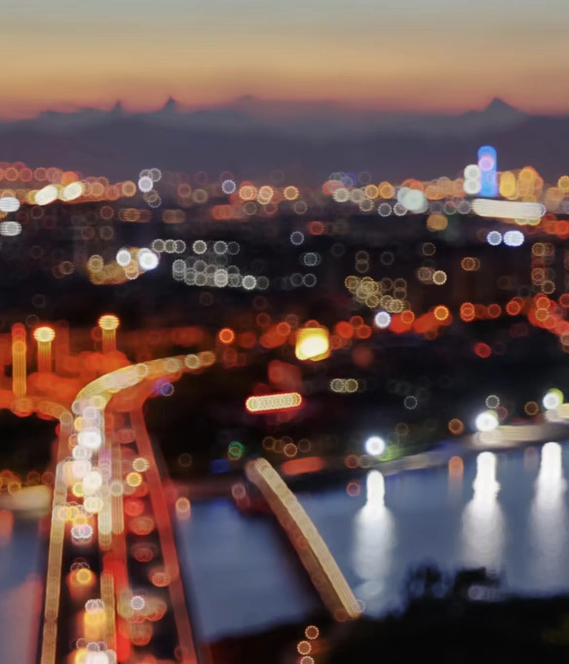 去医院做近视激光手术全部过程,多年前做近视激光手术的怎么样了