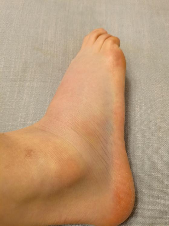 刘畊宏的健身操真的有用吗,人老了腿不行了怎么锻炼身体