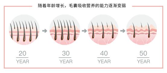 头发硬但是发量少需要烫吗,头发硬能扎到肉里