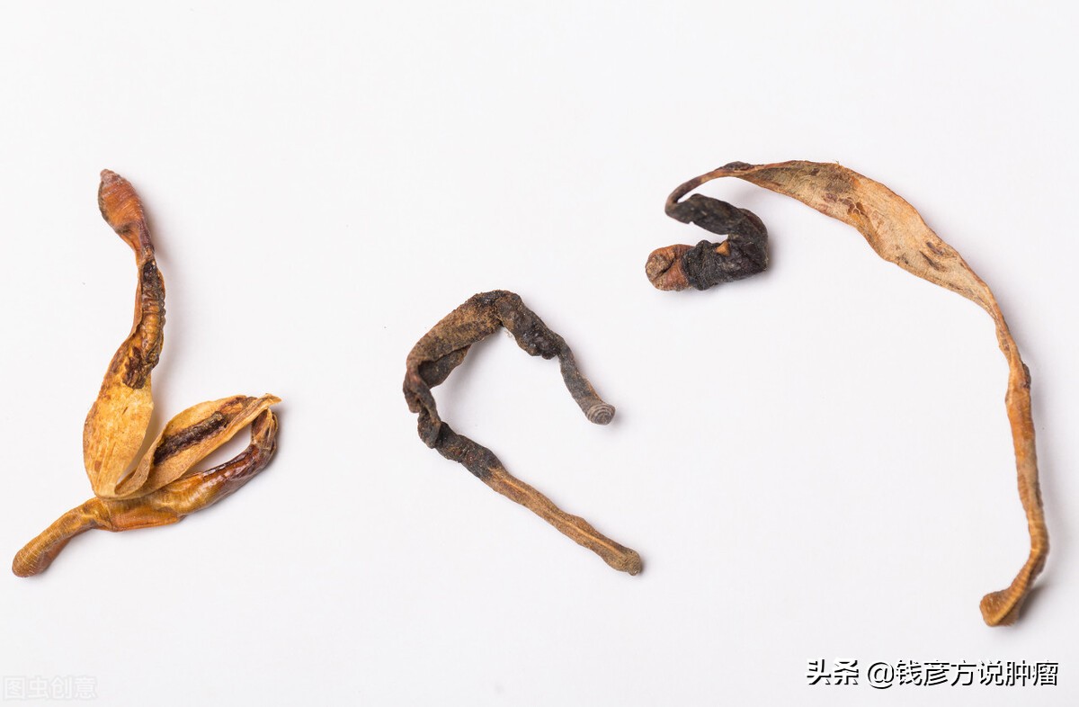 他被诊断为肺癌四期，经过中医治疗，做到与癌症共存13年