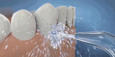 水牙线对比测评,高科技与智商税