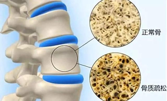 人过50岁4个指标好说明身体健康,体检指标正常不代表身体真正健康