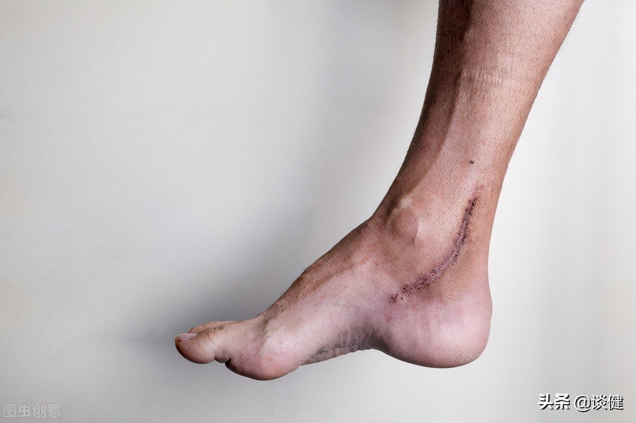 老人运动过度对身体的危害,中老年人运动应注意哪些问题