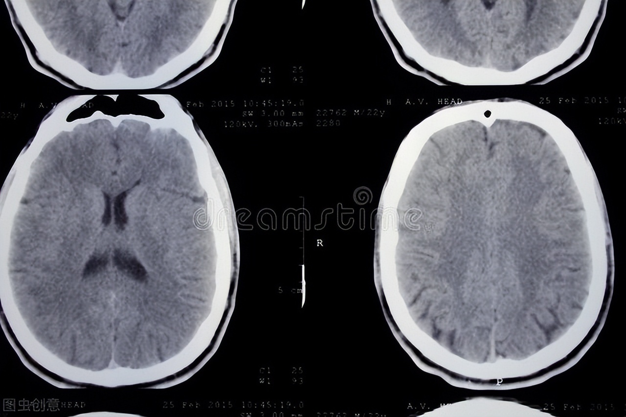 男孩泌尿感染尿急尿频,男性尿频尿血尿痛发热