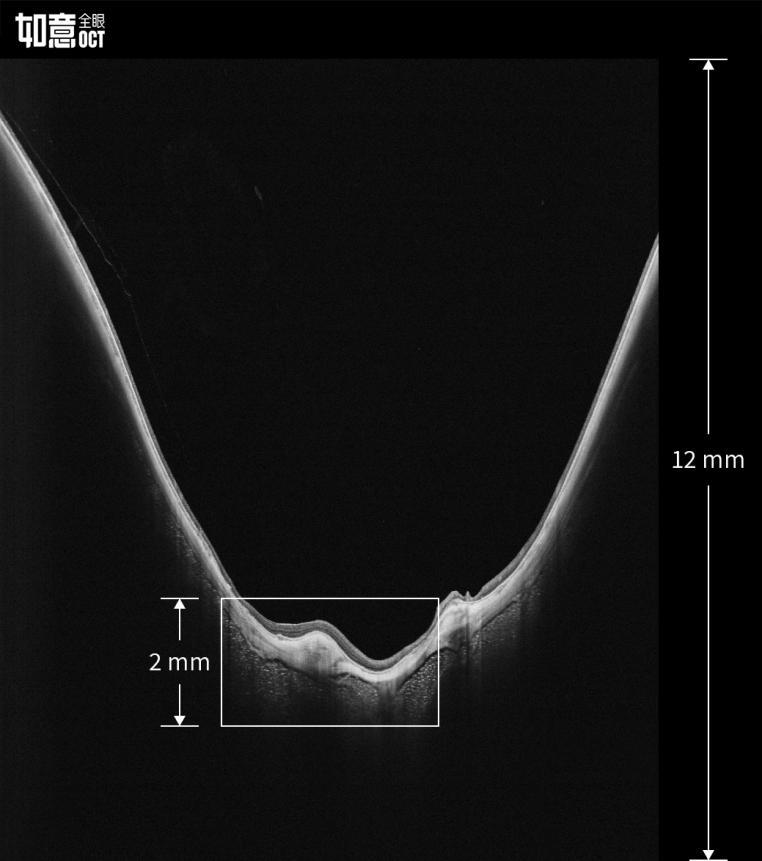 惠民眼科医院,惠民中心医院眼科