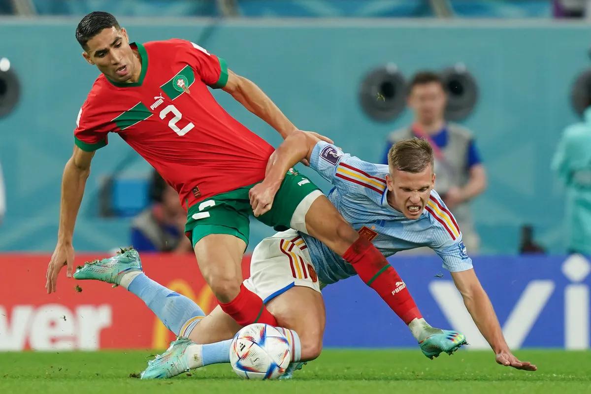 数十个国家临时凑出来的“非洲队”，竟然一黑到底了