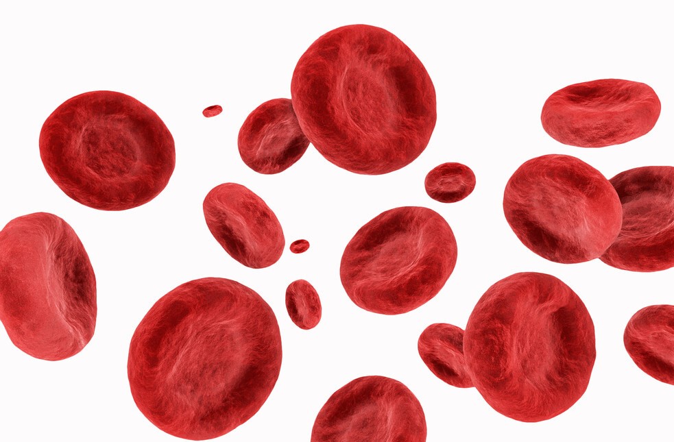 胆红素偏高怎么降,胆红素过高怎么降低