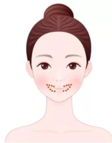 治疗痘痘和痘印最有效的产品内调,腮边反复长大硬包痘痘怎么内调