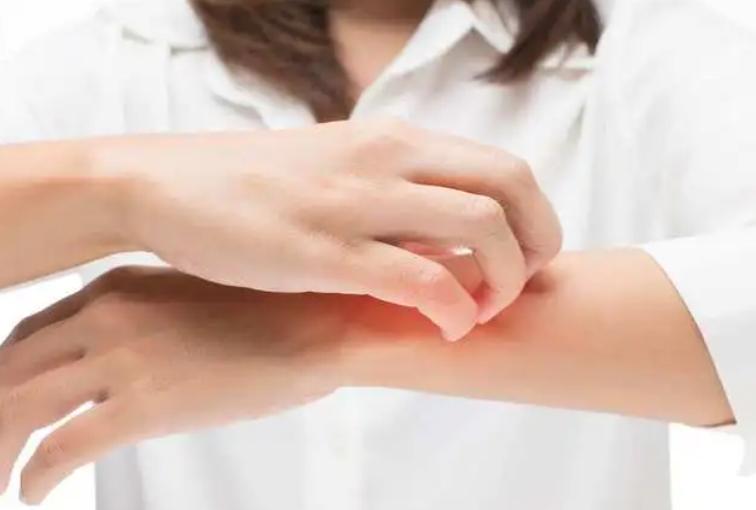 世卫组织推荐炉甘石,炉甘石洗剂哪个牌子的效果比较好