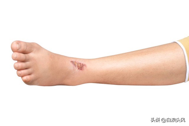 租客被老鼠咬伤房东如何处理,租房期间电路被老鼠咬坏谁负责