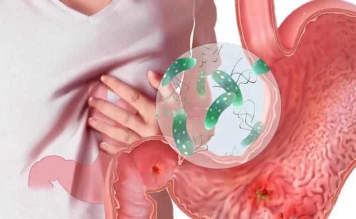 肚子胀是不是肠胃功能紊乱,肠胃检查正常但是肚子总有胀气