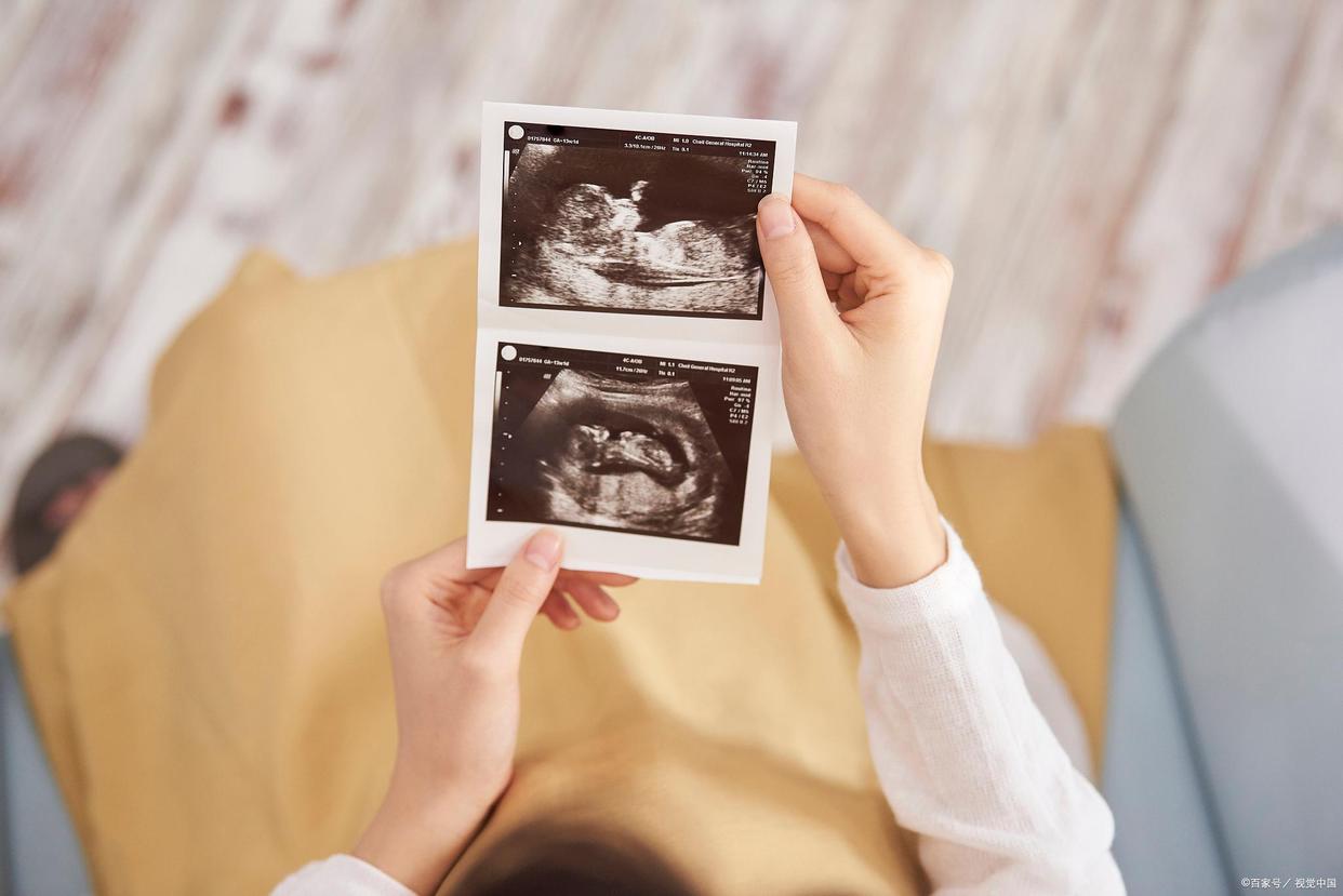 孕期卫生,孕期卫生基础知识