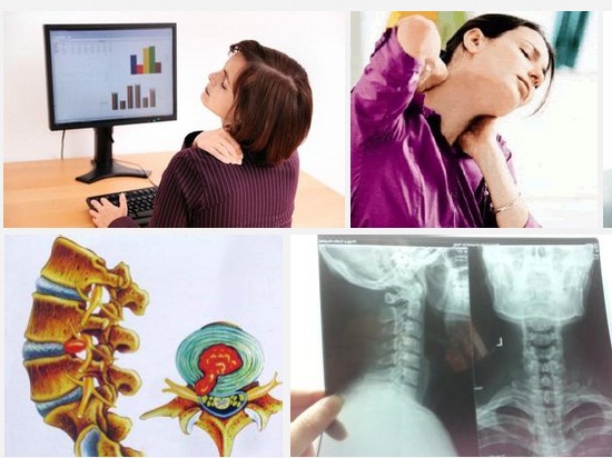 颈椎间盘突出的治疗方法有哪些,颈4567椎间盘向后突出能治愈吗