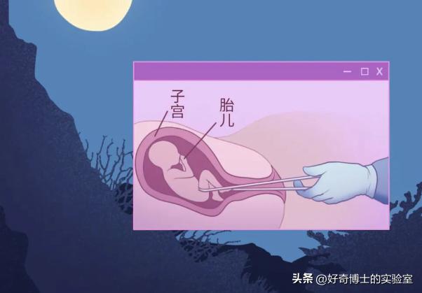 早期人流对子宫的伤害是可逆的吗,人流对女人身体有损伤吗