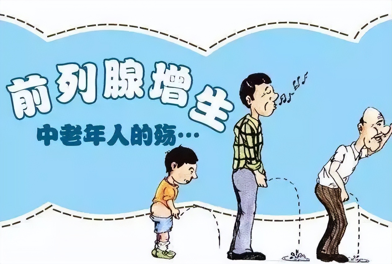 中医前列腺散结化瘀名方,前列腺肥大中草药经典药方