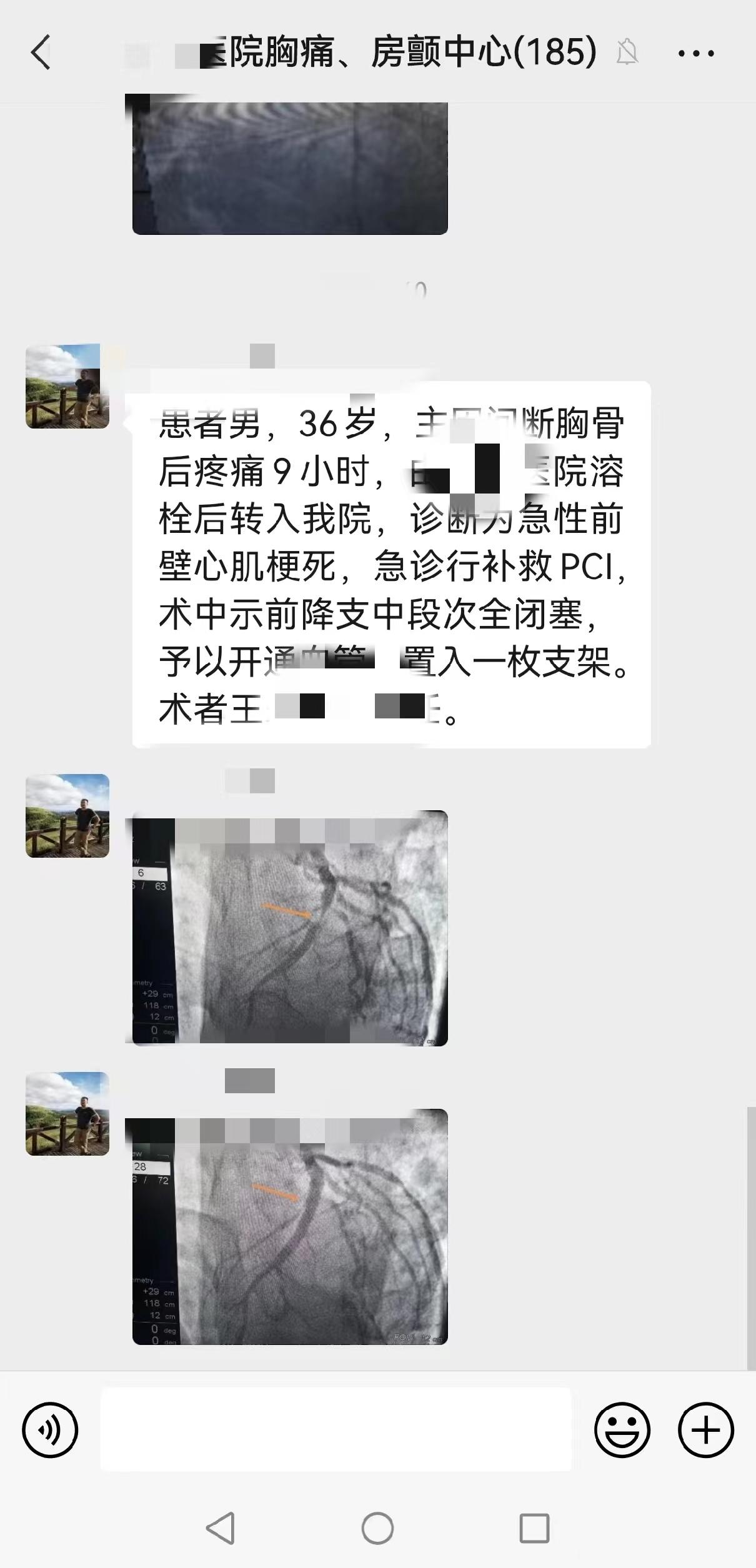 80岁老人得心梗无法手术无法溶栓,42岁突发心梗已下支架