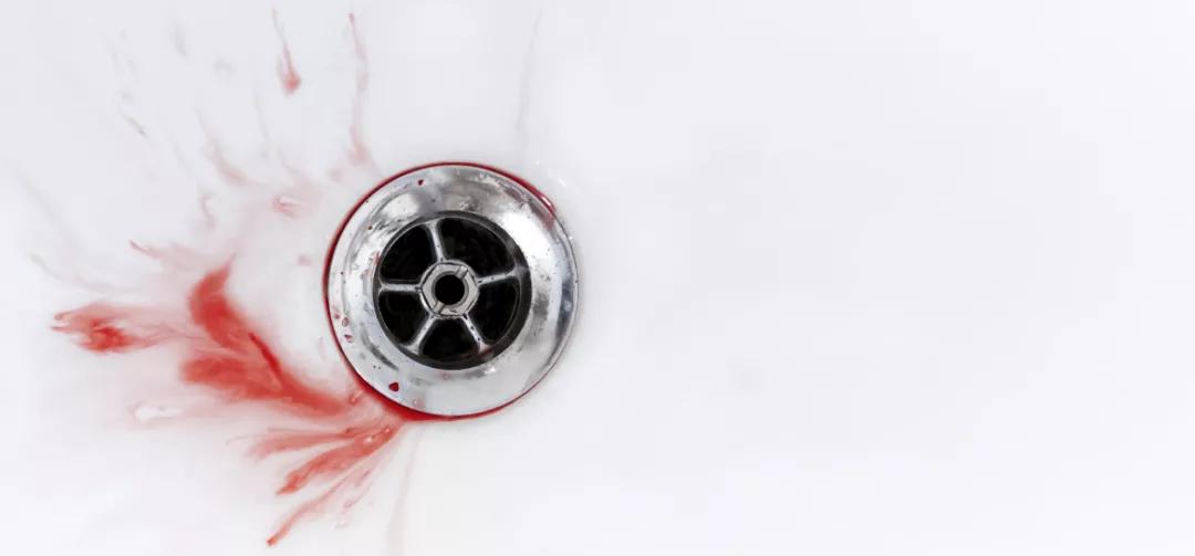 出现血尿没有太在意，熬了两个月被查出早期膀胱癌