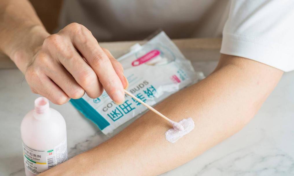 炉甘石洗剂贵的与便宜的有区别吗,炉甘石洗剂世卫推荐