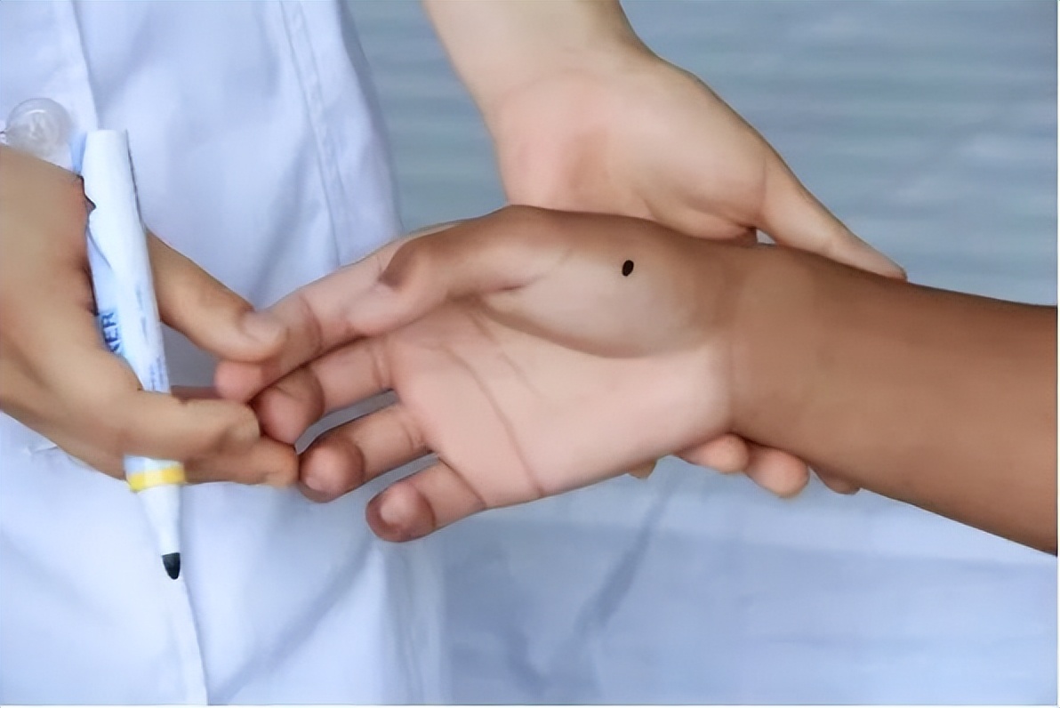 鼠标手手腕疼缓解方法,手握鼠标手麻了怎么办