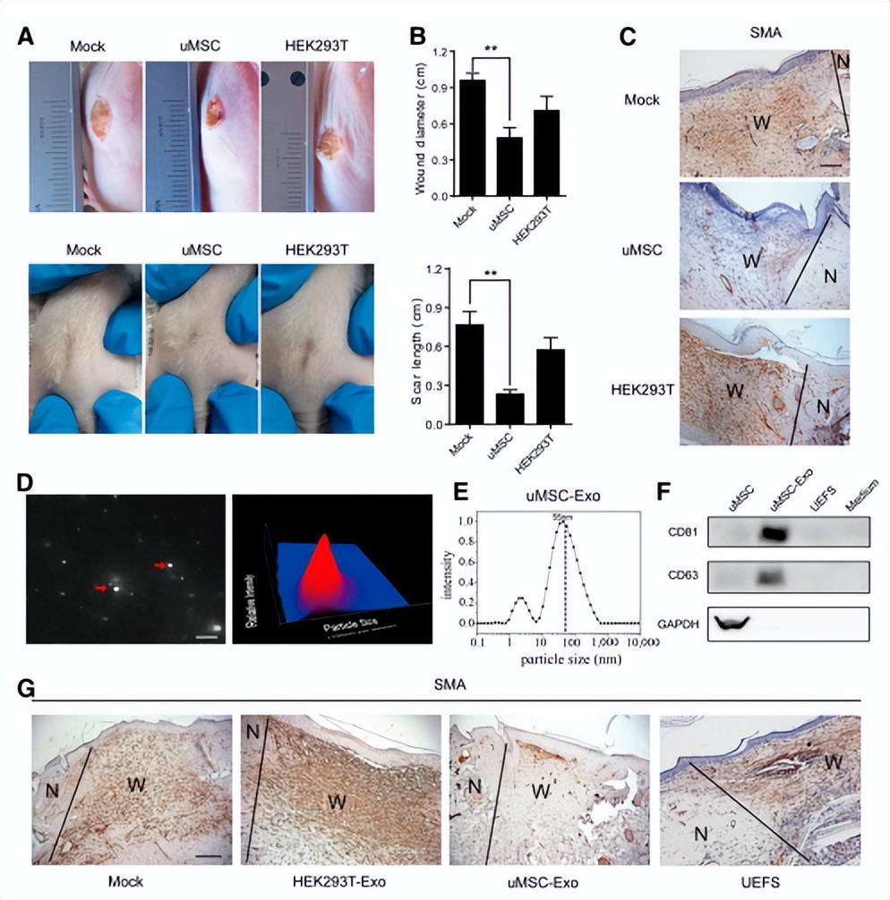 外泌体干细胞美容多长时间见效果,干细胞治疗老年斑多久能痊愈