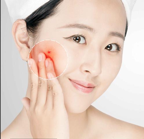 皮肤油腻易出油用什么香皂好,男士夏天皮肤出油