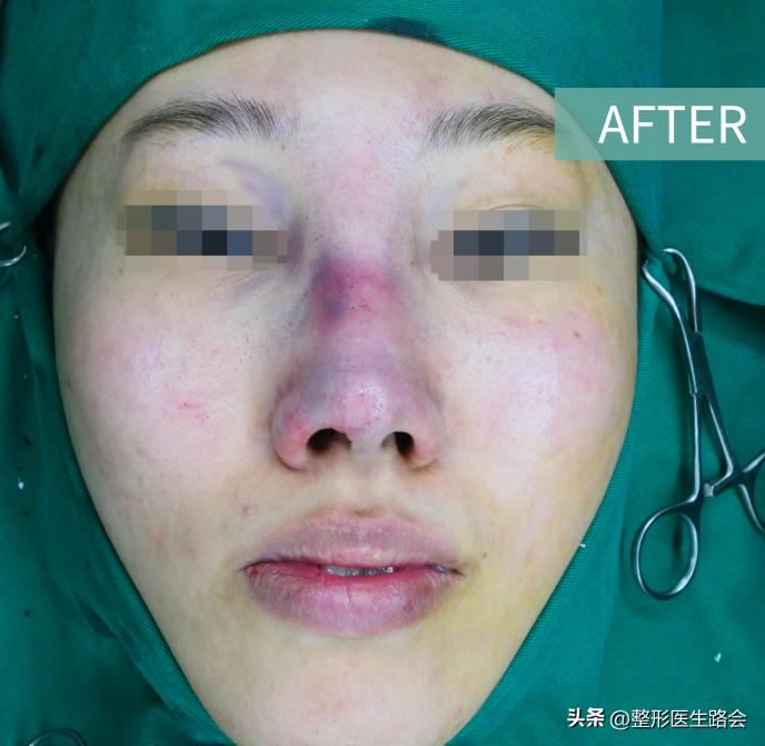 一时冲动做的决定后悔了,一时冲动做出错误的选择