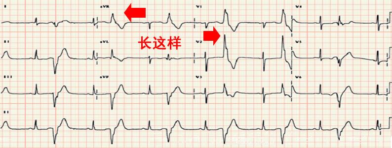 心跳加快不是心动是有病,心跳比较快是心脏病吗