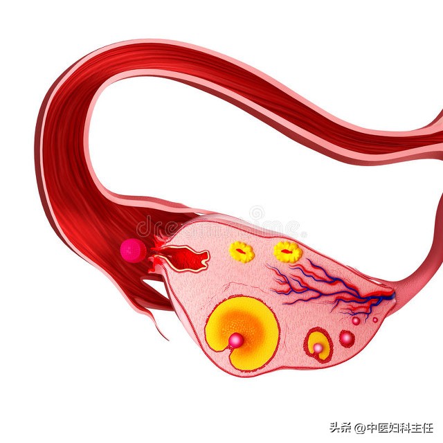 子宫腺肌症的气滞血瘀吃什么药好,子宫腺肌症止痛穴位