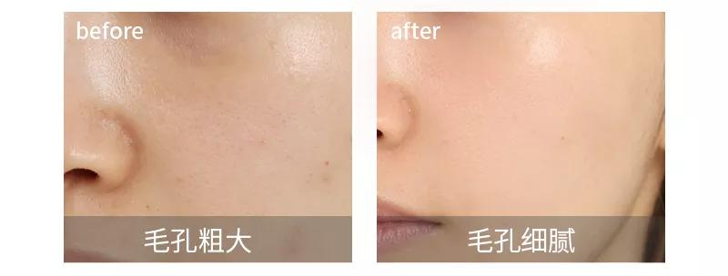 泥膜用多了屏障受损,护肤品推荐泥膜