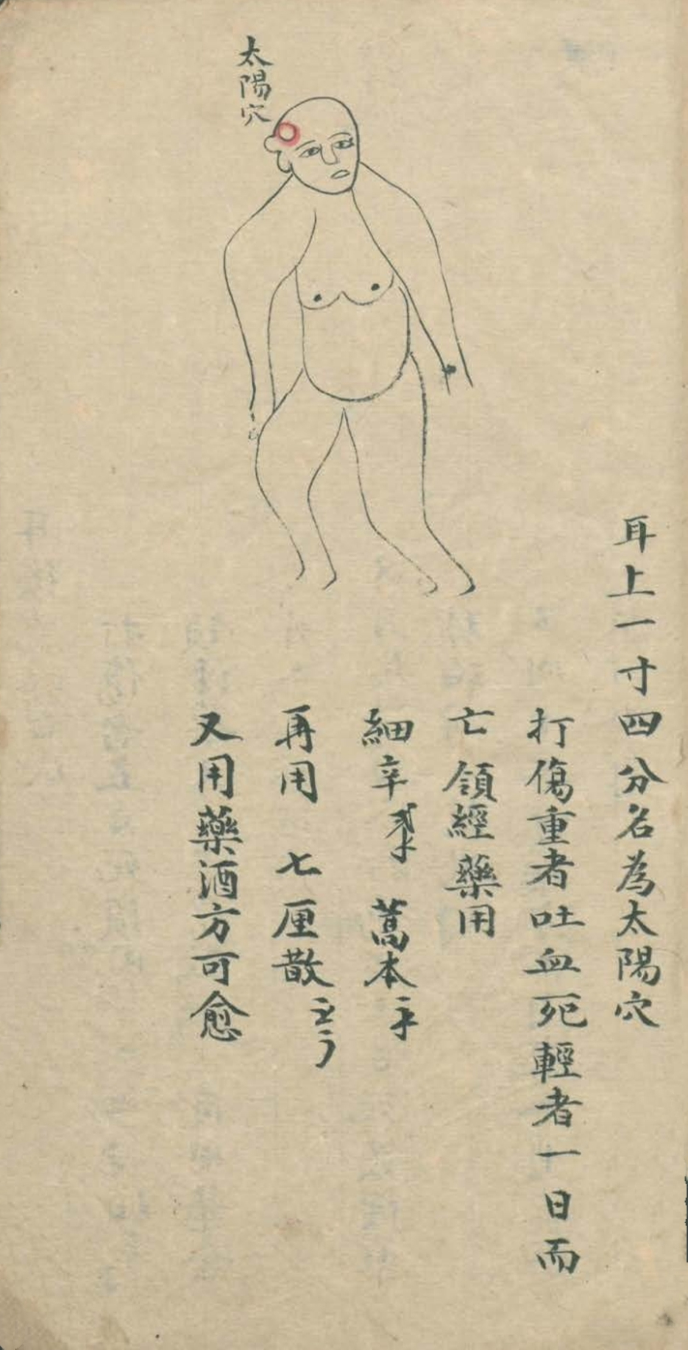 最实用的跌打药方,祖传跌打秘方100首