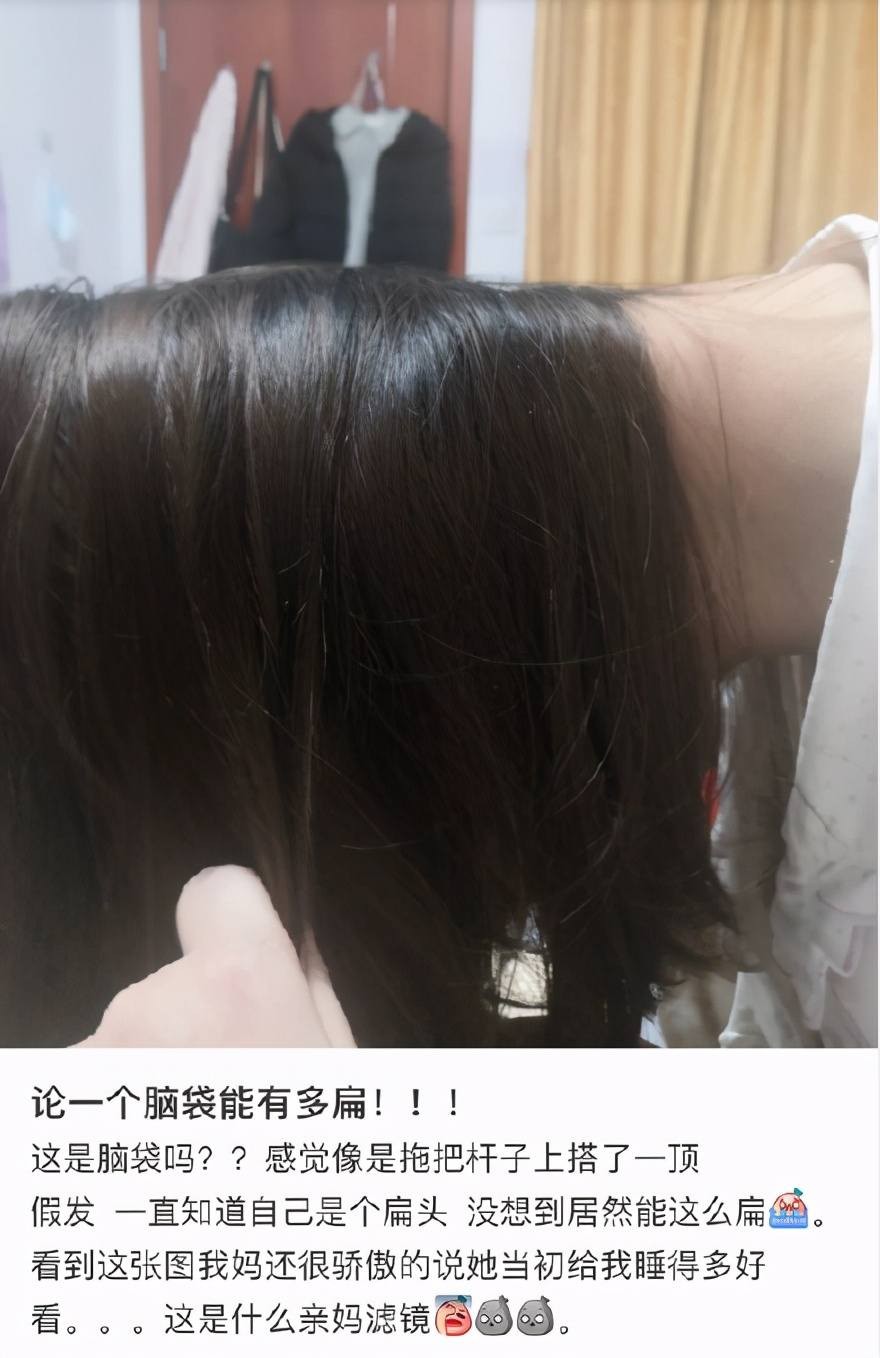 扁头有多毁颜值,扁头对颜值影响有多大